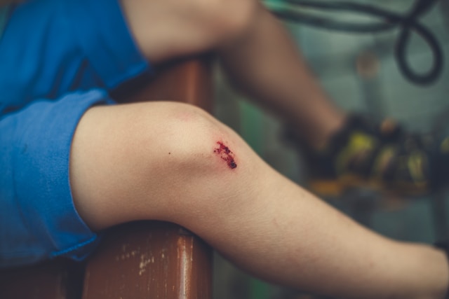 Prevent wound infections in Floods